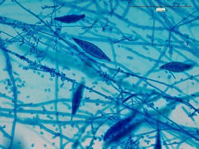 Fun With Microbiology (What's Buggin' You?): Microsporum canis