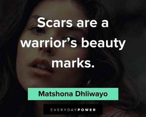 Quotes About Scars And Beauty