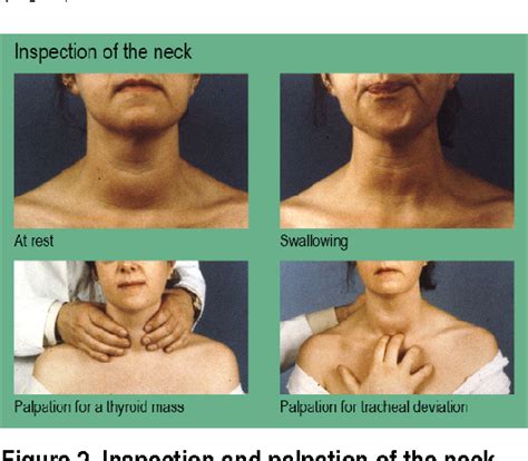 Figure 3 From Examination Of The Thyroid Gland And Thyroid Status