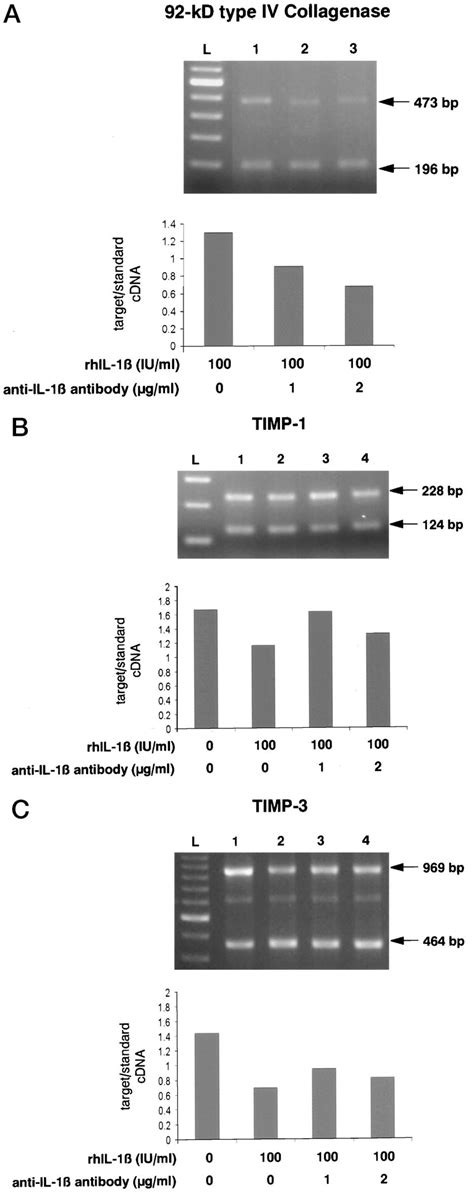 Il Mediated Up Regulation Of Kda Type Iv Collagenase Mrna