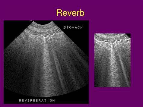 Ppt Ultrasonography Powerpoint Presentation Free Download Id623027