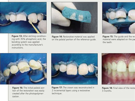 The Reference Guide A Step By Step Technique For Restoration Of