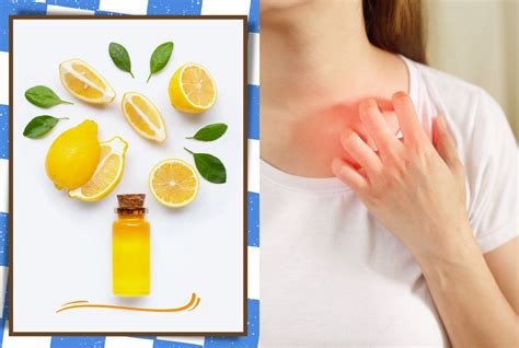 Home Remedies For Itching Skin - Skincell.org