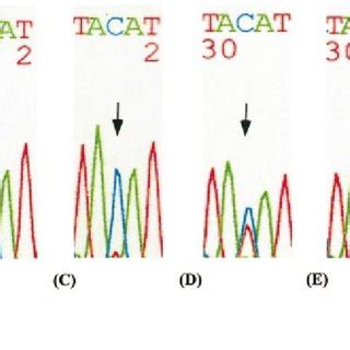 Sequence Chromatograms Of The Gtl Locus Amplified From Control And