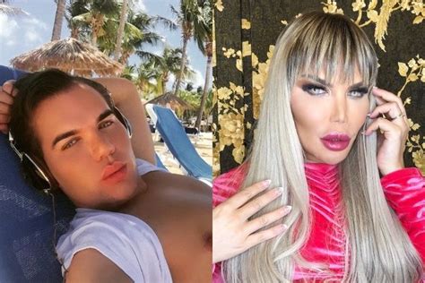 Rodrigo Alves Prima E Dopo Cambiato L Ex Ken Umano Che Oggi