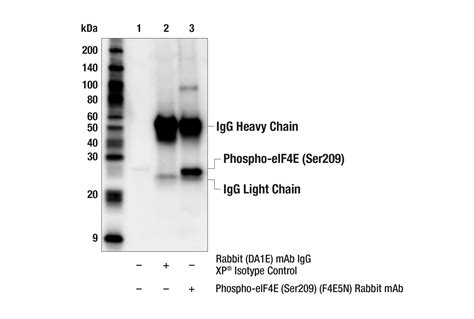 Phospho Eif4e Ser209 F4e5n Rabbit Mab Cell Signaling Technology