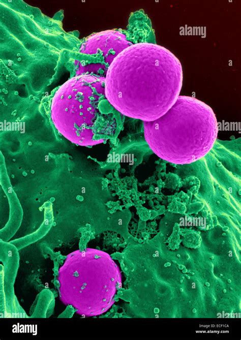 Scanning Electron Micrograph Of A Human Neutrophil Ingesting Mrsa Stock