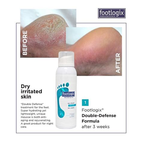 Footlogix Dd Cream Mousse 125 Ml Shopee Malaysia