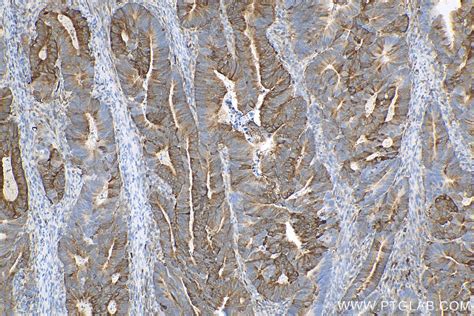 Phgdh Antibody Rr Proteintech