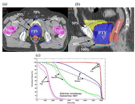 Physical And Radiobiological Evaluation Of Radiotherapy Treatment Plan