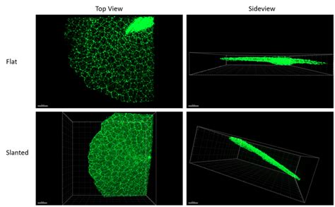 Confocal Microscopy Z Stack