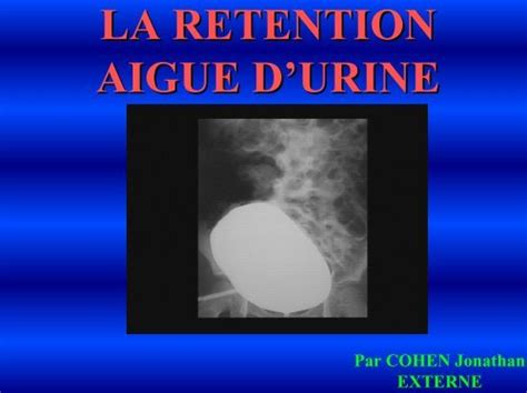 R Tention Aigue D Urine Service D Urologie Chu Henri Mondor