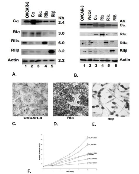 Pka Subunit Overexpression In Human Ovarian Cancer Cells Ovcar A