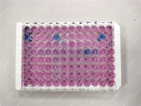 Premium Photo Enzyme Linked Immunosorbent Assay Elisa Plate