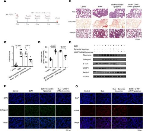 JCI Insight Liposomal UHRF1 SiRNA Shows Lung Fibrosis Treatment