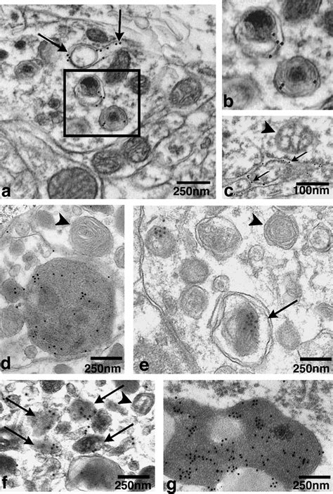 Immunogold Electron Microscopy Of Brain Avs Highly Selective