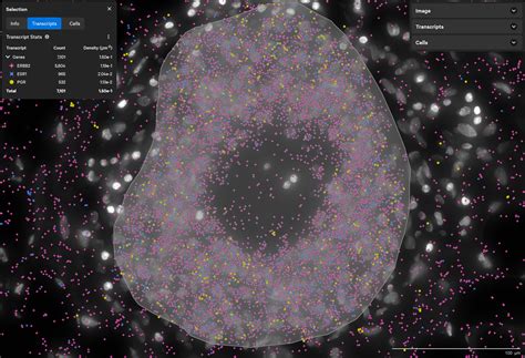 Human Breast Dataset Explorer 10x Genomics