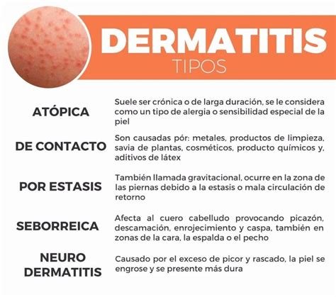 Dermatitis Qu Es Causas S Ntomas Tratamiento Y Mucho M S