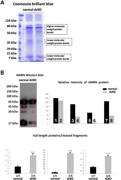 Coomassie Brillaint Blue Staining Of The Total Protein Extract And Download Scientific Diagram