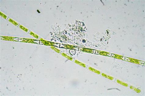 Algae under a microscope. stock image. Image of micro - 113554695