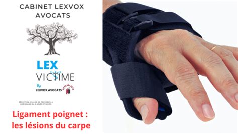 Ligament Poignet Les L Sions Du Carpe