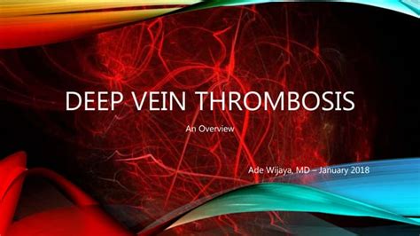 Deep Vein Thrombosis Ppt