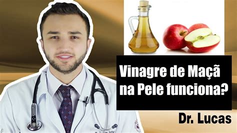 Vinagre De Ma Na Pele Funciona Dr Lucas Fustinoni Youtube