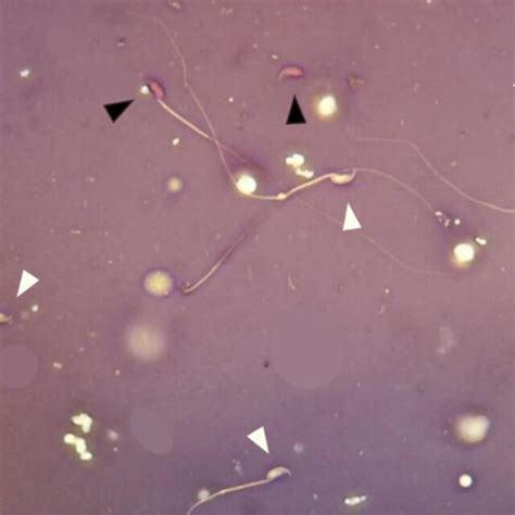 Eosin Nigrosine Staining Of Spermatozoa Of Mice Mus Musculus After Download Scientific