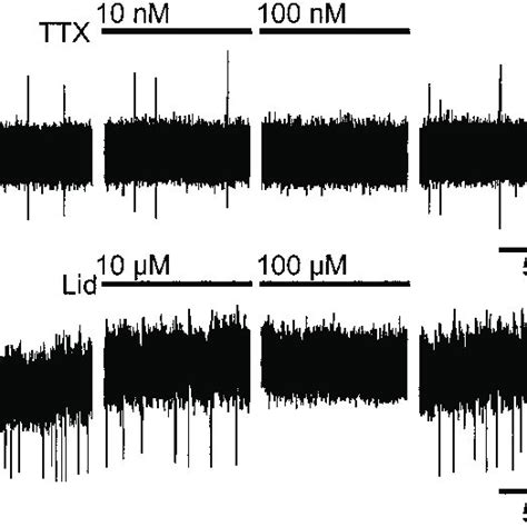 Effect Of Tetrodotoxin TTX And Lidocaine Lid On Spontaneous Current