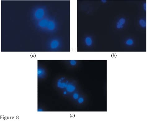 Figure From Synthesis Crystal Structure And Biological Properties Of