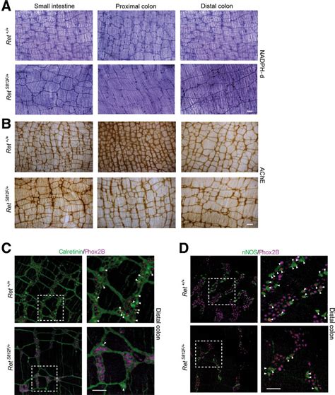 Histochemical Analysis Of Enteric Neurons And Their Differentiation