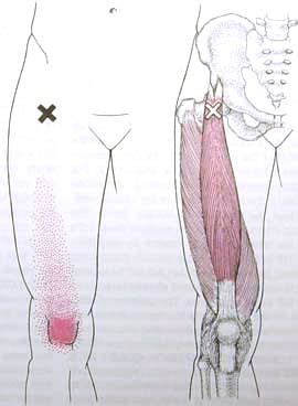 The Quadriceps Muscles Yoga Anatomy Yoga Anatomy Trigger Points