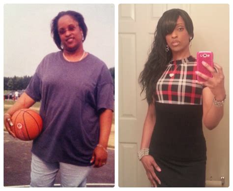 Member Spotlight-Weight Loss Surgery Before and After : ObesityHelp