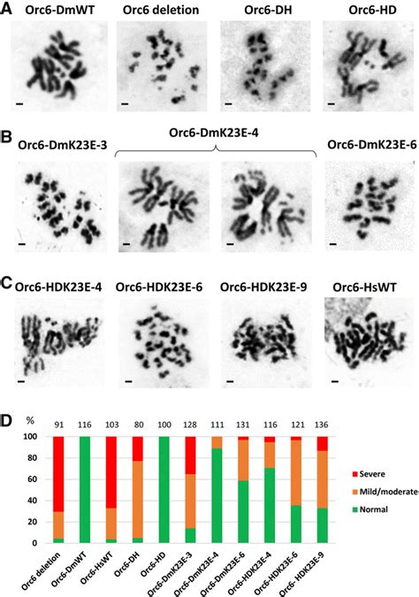 Figure From Humanized Drosophila Model Of The Meier Gorlin Syndrome