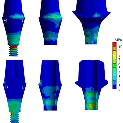 The Von Mises Stress Distribution Of Abutment Screw In Buccal Upper Download Scientific