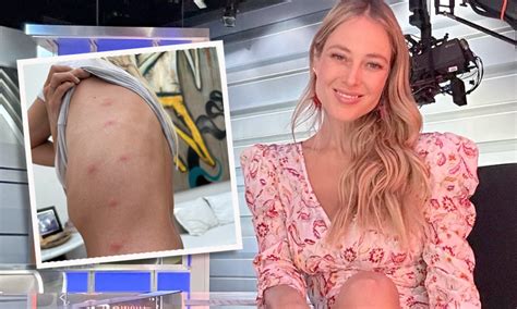 Enciende Las Alarmas Vanessa Huppenkothen Preocupa En Redes Por