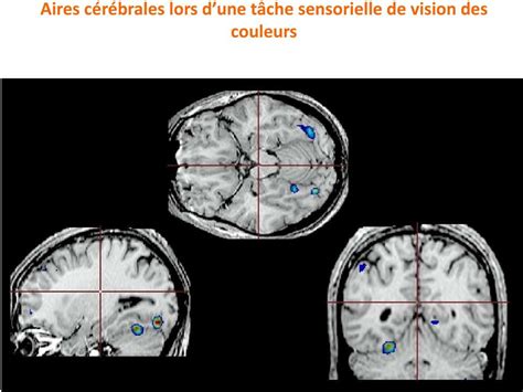 Thème 3C de l œil au cerveau quelques aspects de la vision Chapitre 2