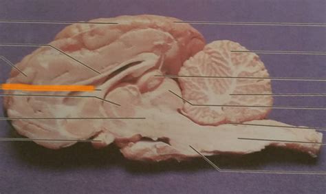 Sheep Brain Medial View Of Sagittal Cut Part II Flashcards Quizlet