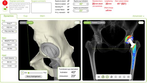 Hip Replacement Surgeon Perth, Hip Surgeon | William Blakeney