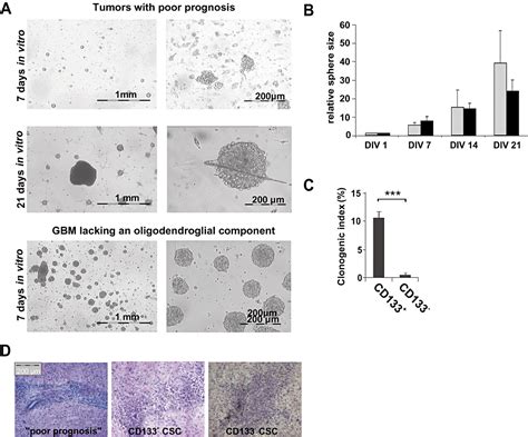 Cd133 Expression And Cancer Stem Cells Predict Prognosis In High‐grade