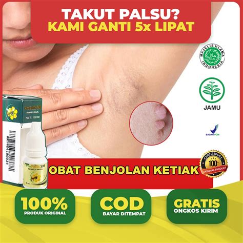 Jual Obat Benjolan Diketiak Benjolan Bengkak Benjolan Sakit Obat