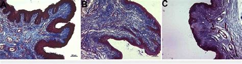 Histopathological Examination Of The Lamina Propria A Control Group