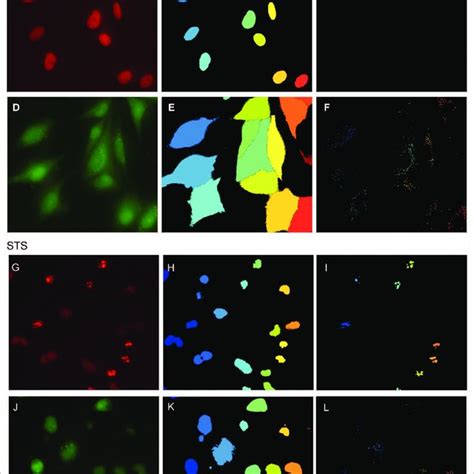 Image Analysis Of Autophagy And Apoptosis H Cells Stably Expressing