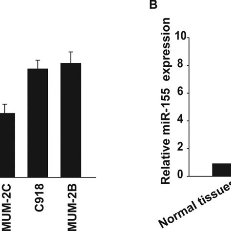 The Expression Of Mir 155 Is Upregulated In Uveal Melanoma Cells And