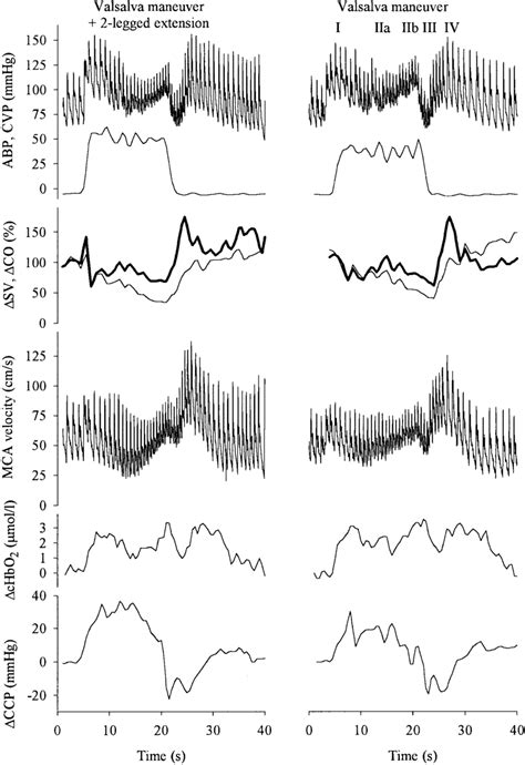 Recording During Two Legged Static Exercise With A Concomitantly Download Scientific Diagram