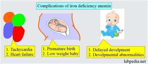 Anemia Part 2 Iron Deficiency Anemia Microcytic And Hypochromic