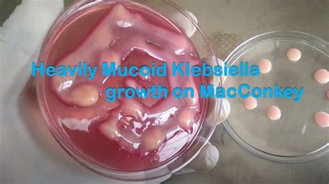 Heavily Mucoid Lactose Fermenting Colony Of Klebsiella Pneumoniae