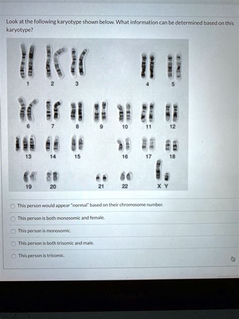 Solved Lookat The Following Karyotype Shown Below What Information Can