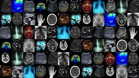 Deep Learning For Medical Imaging And Healthcare Nanonets