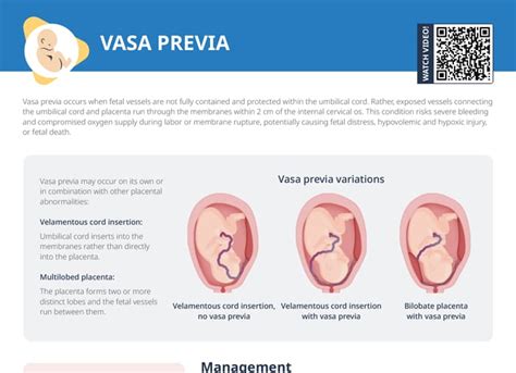 Vasa Previa Free Cheat Sheet Lecturio Nursing